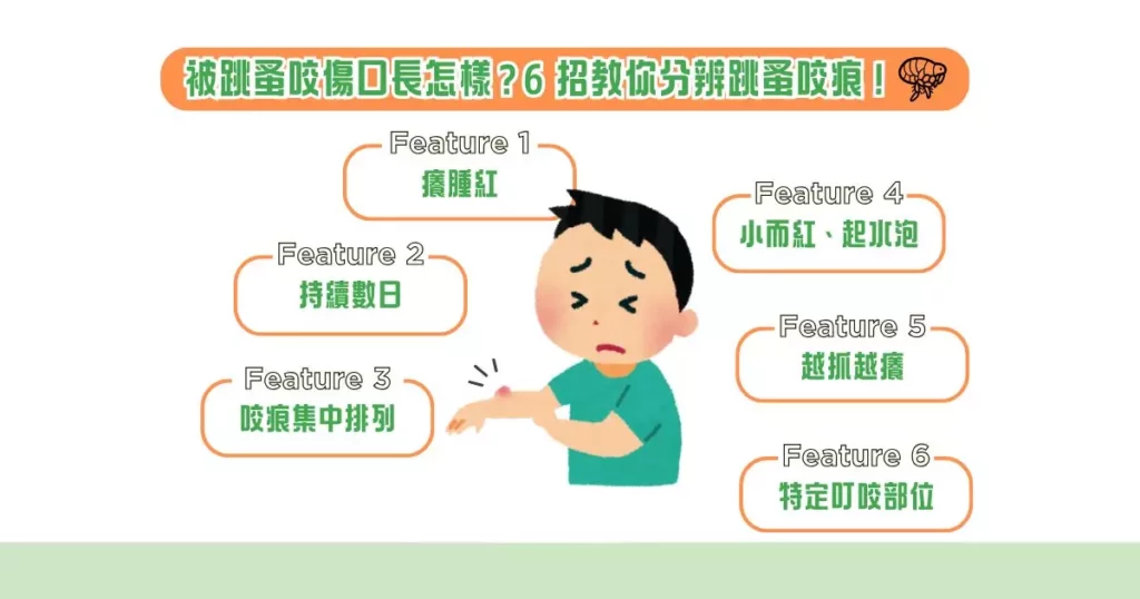被跳蚤咬傷口長怎樣？6 招教你分辨跳蚤咬痕！