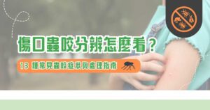 傷口蟲咬分辨怎麼看? 13 種常見蟲咬症狀與處理指南